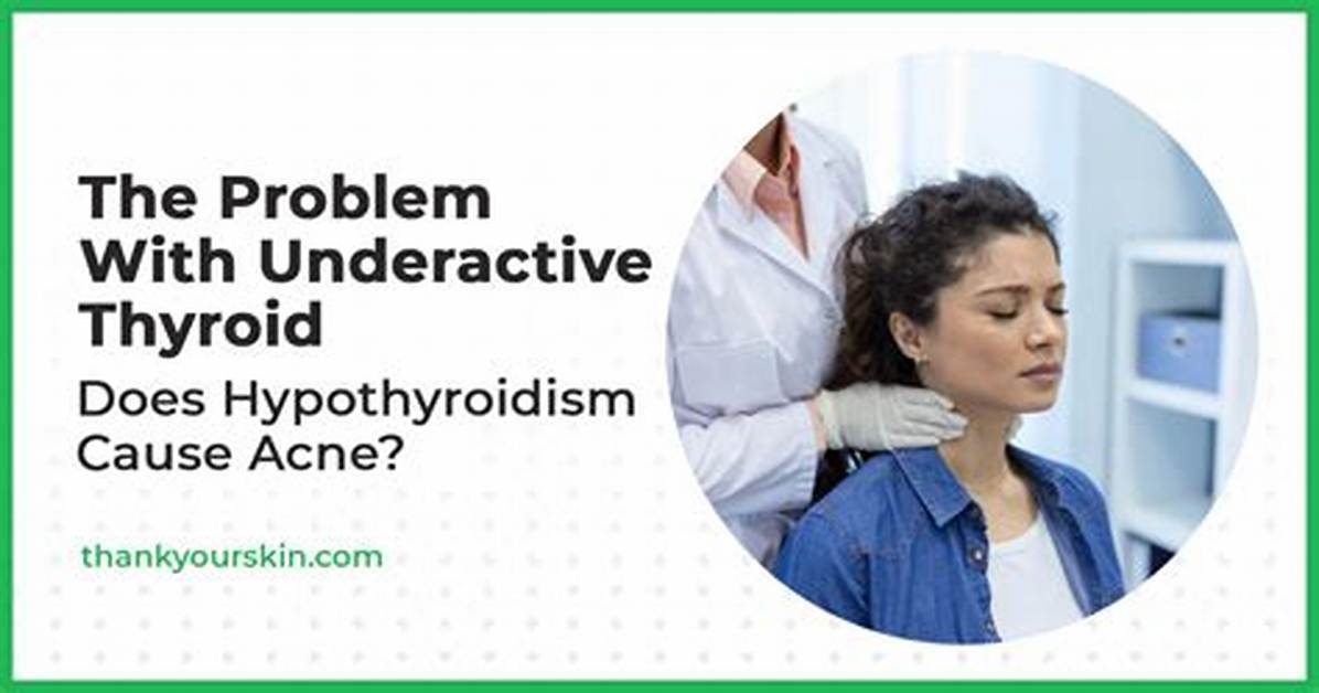 Can Hypothyroidism Cause Acne?