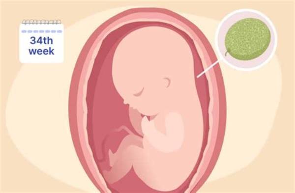 Can I Have a Baby at 34?