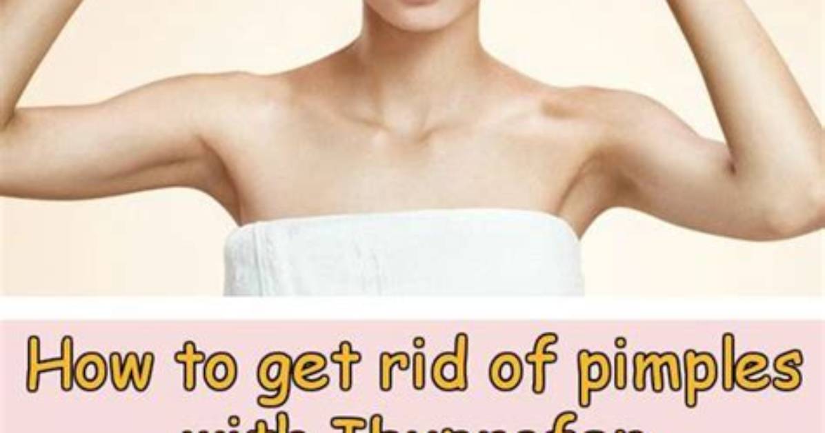 Can I Put Ibuprofen on a Pimple?