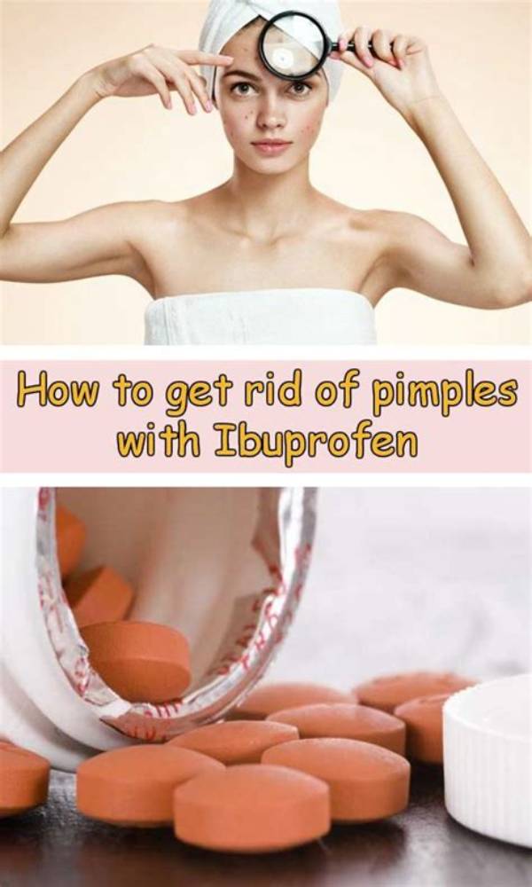 Can I Put Ibuprofen on a Pimple?
