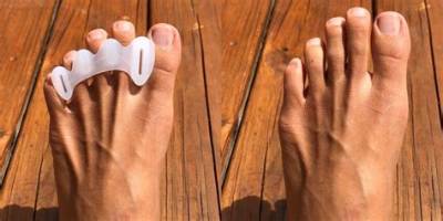 Can I Wear Correct Toes to Bed?