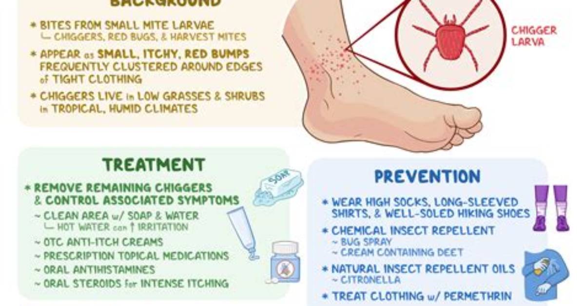 Can Jiggers Kill You?