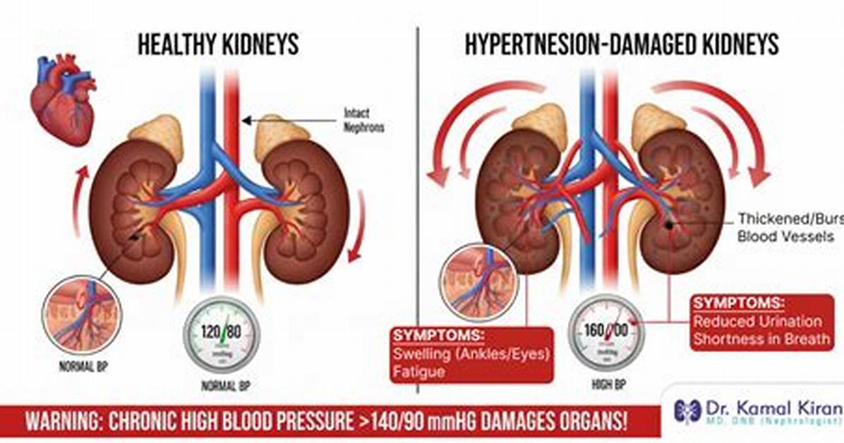 Can Kidney Damage from High Blood Pressure Be Reversed?