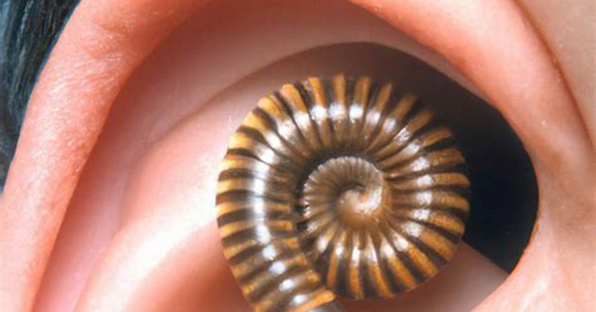 Can Millipedes Crawl in Your Ear?