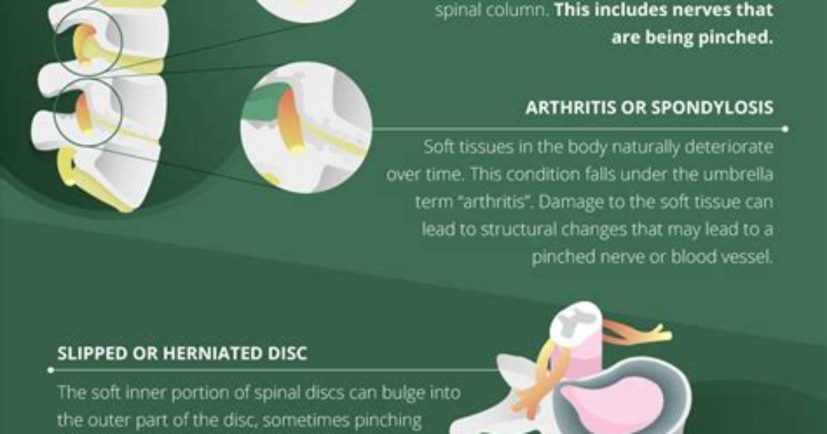 Can Neck Disc Problems Cause Dizziness?