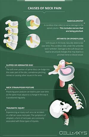 Can Neck Disc Problems Cause Dizziness?