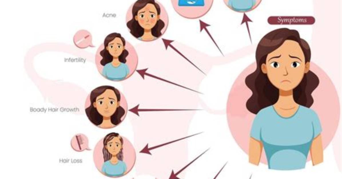 Can Pcos Affect Eyes?