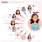 Can Pcos Affect Eyes?
