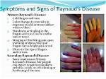 Can Raynaud's Cause Hair Loss?