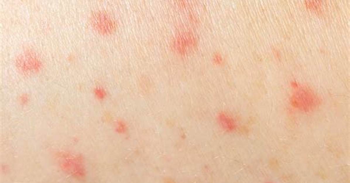 Can Sperm Cause Irritation on Skin?