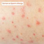 Can Sperm Cause Irritation on Skin?
