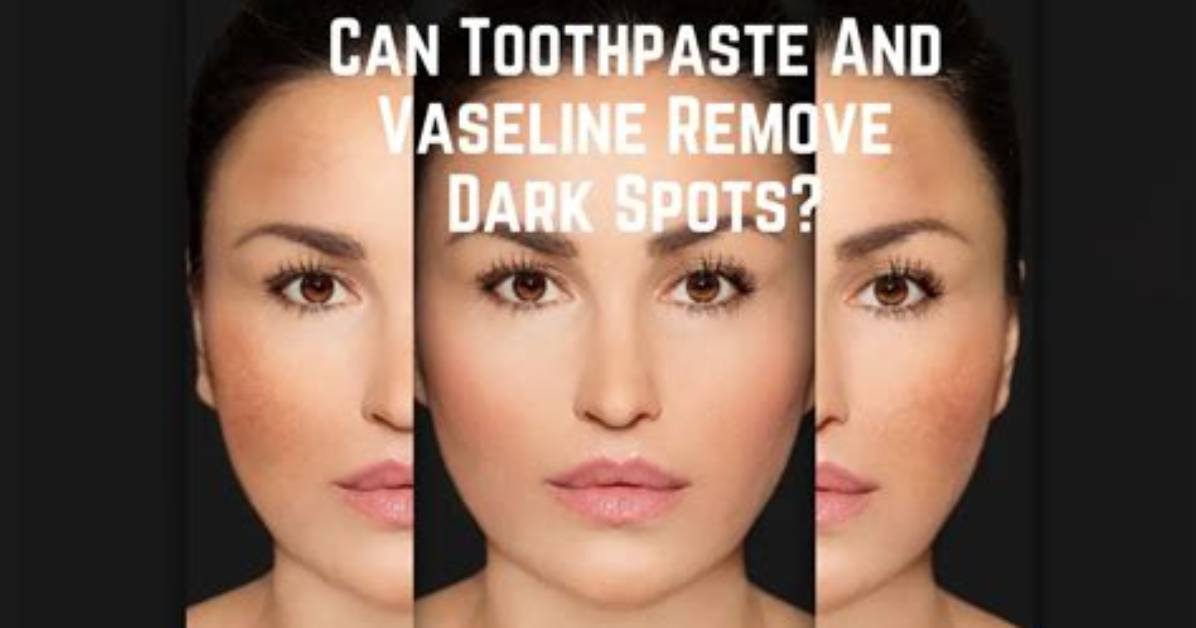 Can Toothpaste Cause Dark Lips?