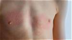 Can You Be Allergic to Titanium Dioxide?