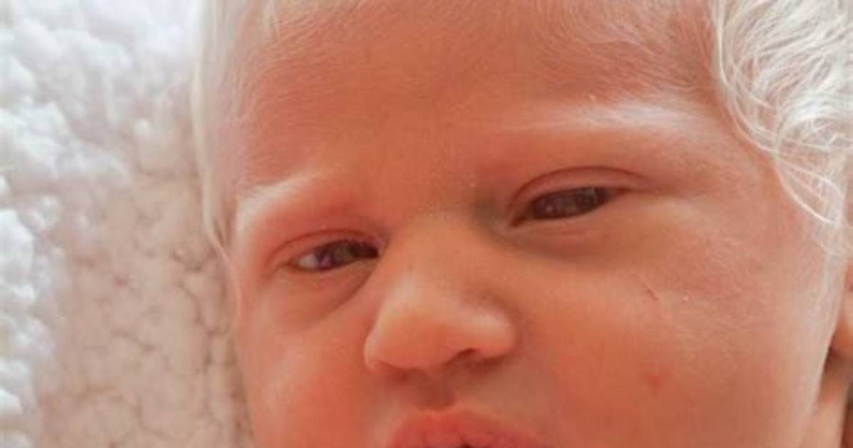 Can You Be Born with White Hair?