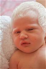 Can You Be Born with White Hair?
