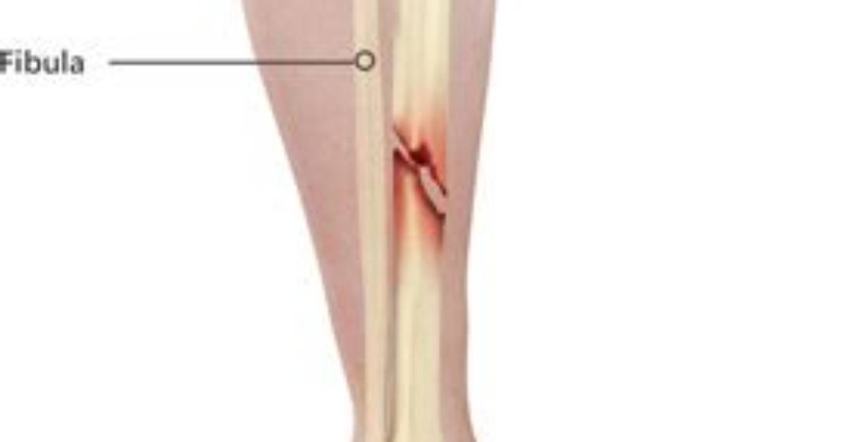 Can You Break Your Shinbone?