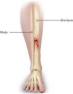 Can You Break Your Shinbone?