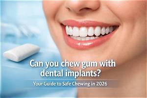 Can You Chew Gum with Implants?