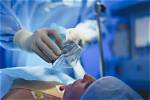 Can You Choke While Under Anesthesia?