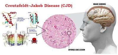 Can You Get Cjd from Pork?