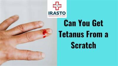 Can You Get Tetanus from a Scratch That Doesn't Bleed?