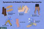 Can You Have Neuropathy Without Having Diabetes?