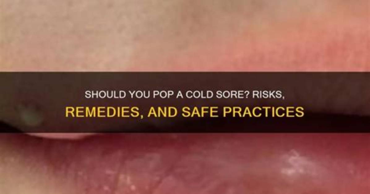 Can You Pop a Cold Sore Safely? Everything You Need to Know