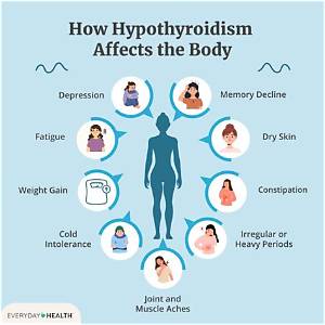 Can You Reverse Hypothyroidism?