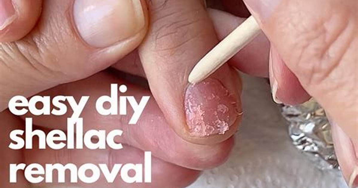 Can You Shellac Toenails?