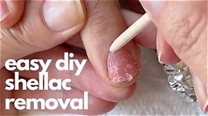 Can You Shellac Toenails?