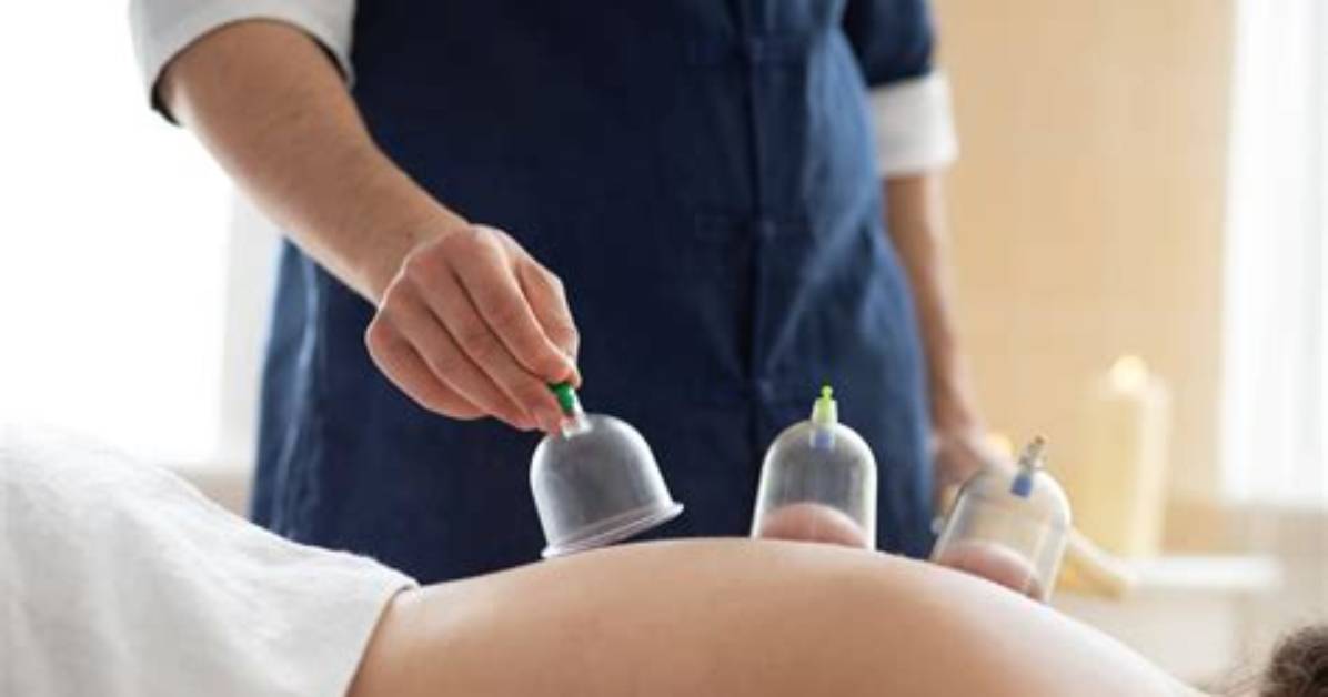 Can You Take a Bath After Cupping?