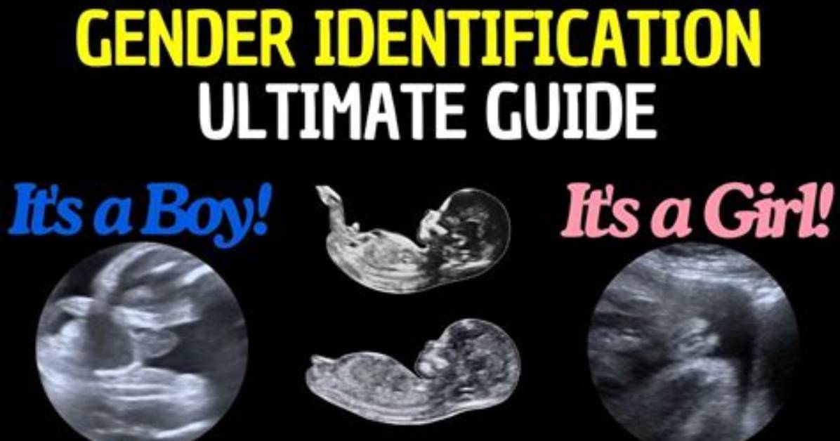 Can You Tell If a Baby Is Intersex in the Womb?
