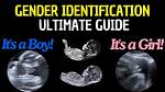 Can You Tell If a Baby Is Intersex in the Womb?