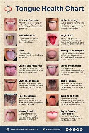 Can Your Tongue Show Signs of Illness?