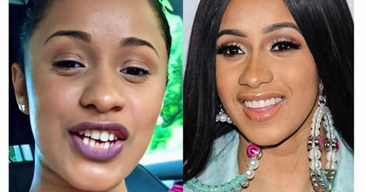 Cardi B Teeth: the Story Behind Her Iconic Smile