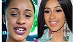 Cardi B Teeth Then and Now