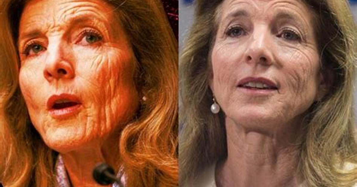Caroline Kennedy Sun Damage Understanding the Impact and Finding