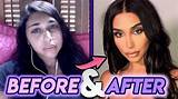 Chantel Jeffries Plastic Surgery Before and After