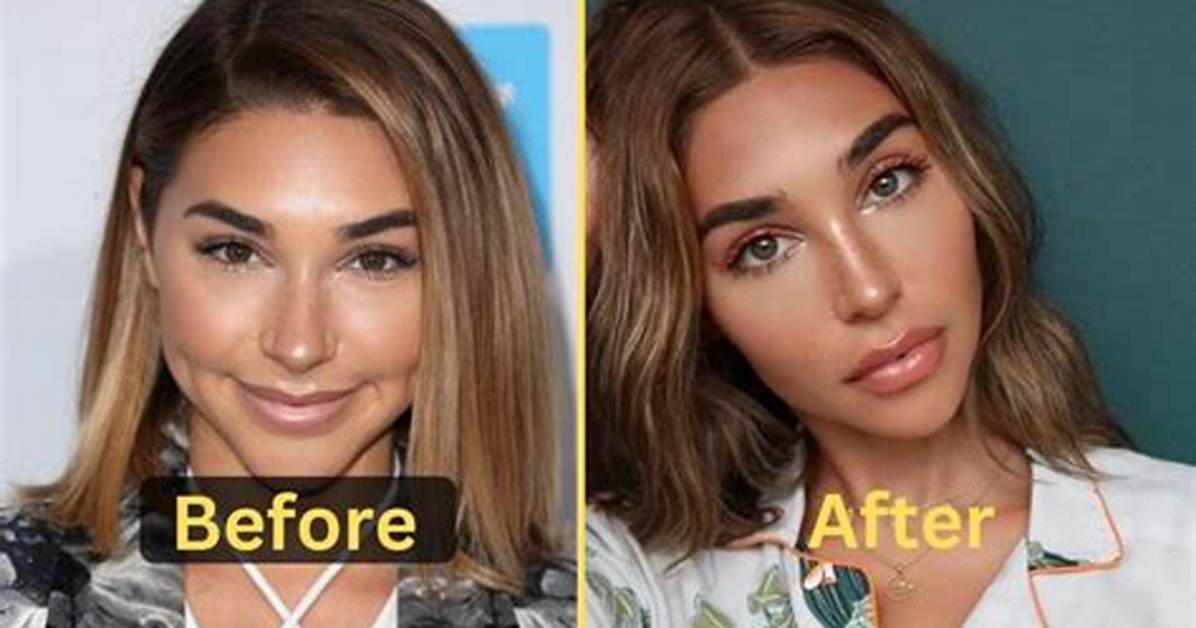 Chantel Jeffries Plastic Surgery Before And