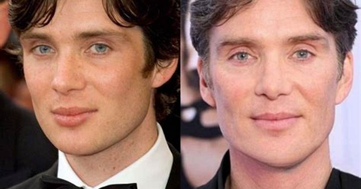 Cillian Murphy's Battle with Malignant Tumor: a Story of Resilience