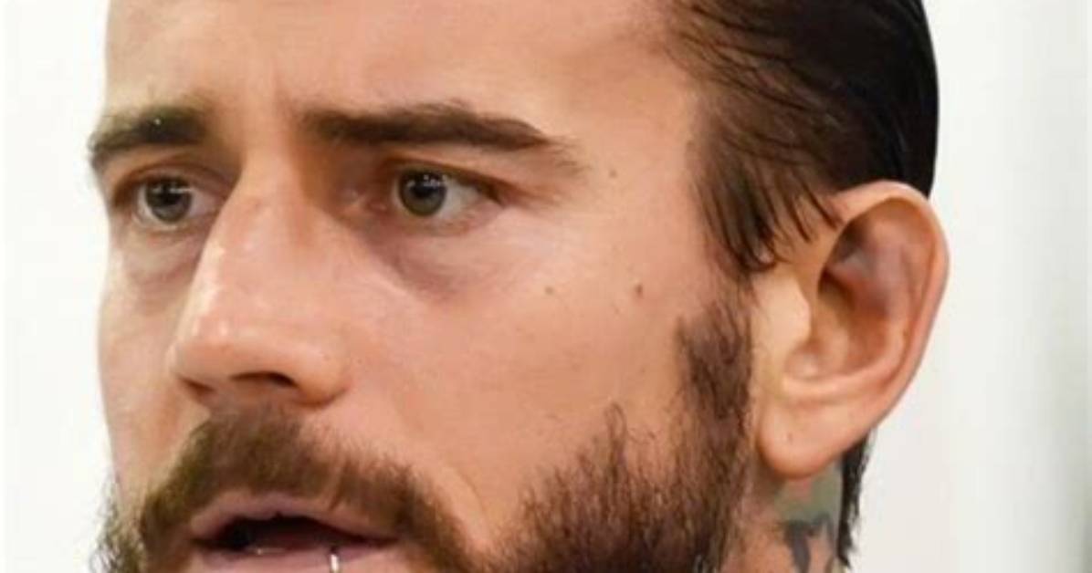 Cm Punk Hair Plugs: the Ultimate Guide to Understanding Hair Restoration