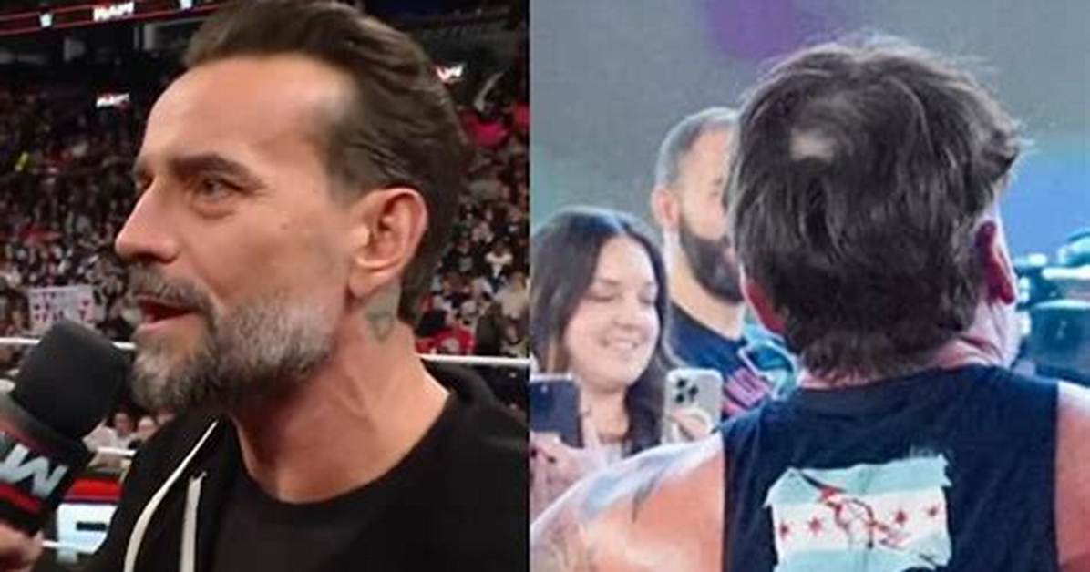Cm Punk Hair Transplant the Ultimate Guide to Restoring Your