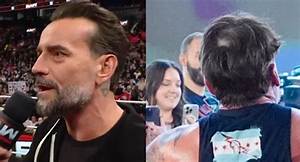 Cm Punk Hair Transplant: the Ultimate Guide to Restoring Your Confidence