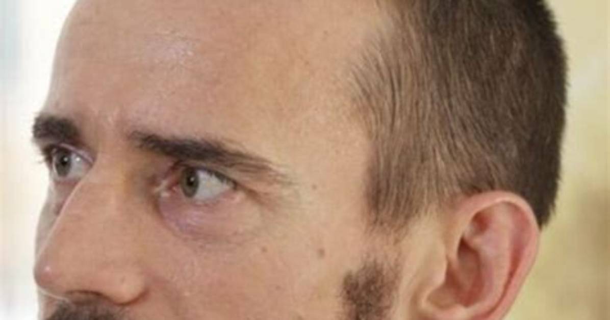 Cm Punk Hairline: a Comprehensive Look at the Evolution, Facts, and Myths
