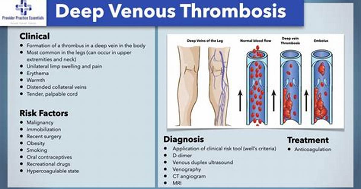 Comprehensive Guide to Acute Deep Venous Thrombosis (Dvt) Icd-10 Codes