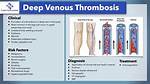 Comprehensive Guide to Acute Deep Venous Thrombosis (Dvt) Icd-10 Codes
