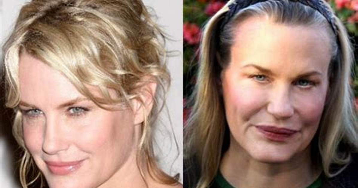 Daryl Hannah S Plastic Surgery Journey Before And