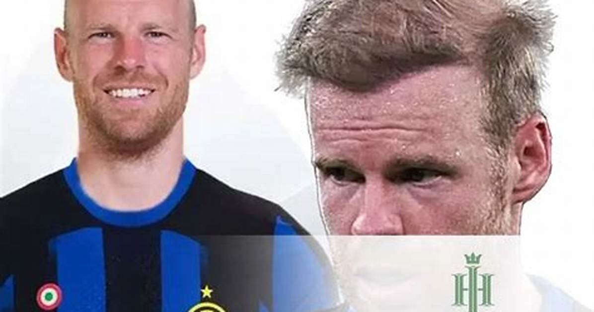 Davy Klaassen Have No Hair Looks Does He Have Alopecia Or