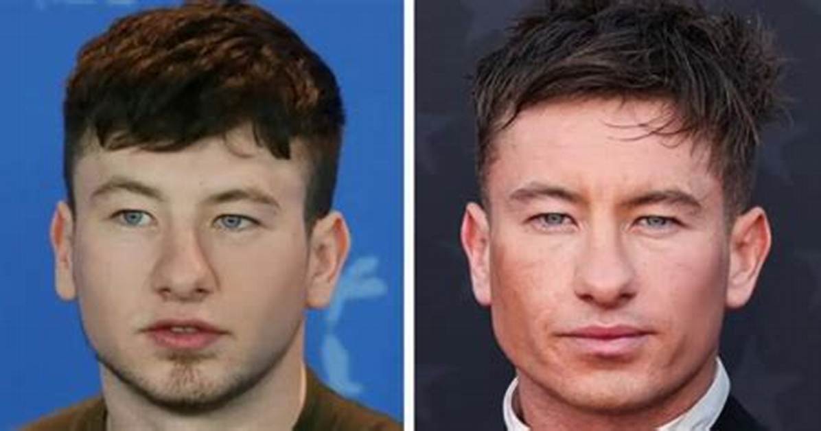 Did Barry Keoghan's Radical Transformation Involve Plastic Surgery?
