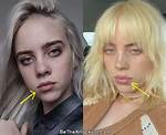 Did Billie Eilish Get a Breast Reduction?